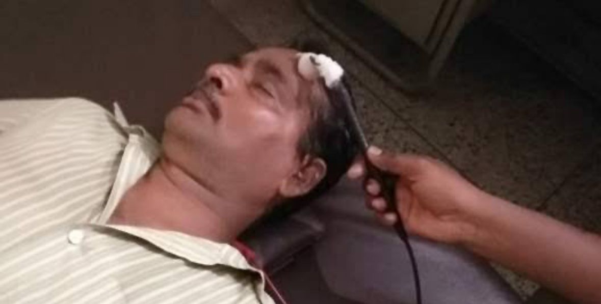 Electrical Stimulation